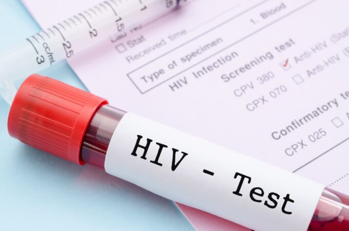 provetta per il test dell'hiv